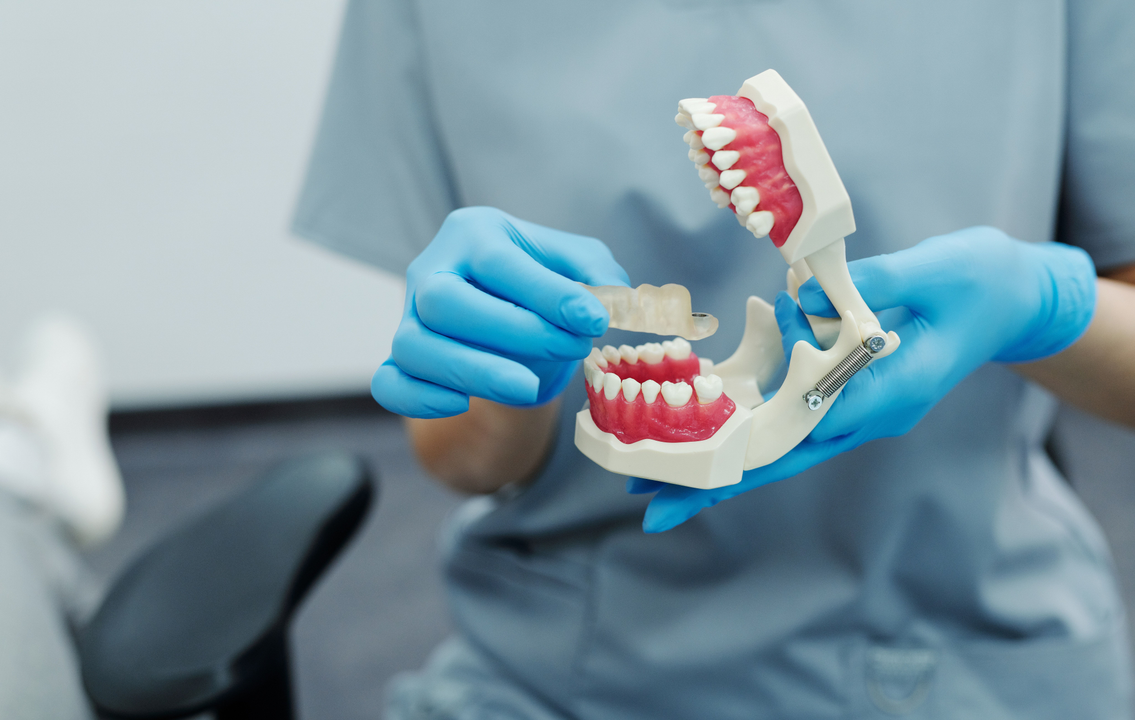 clinica dental molina Revi